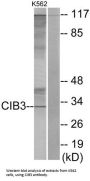 Calcium And Integrin Binding Family Member 3 (CIB3) Antibody