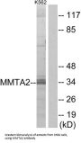 Multiple Myeloma Tumor-Associated Protein 2 (MMTAG2) Antibody