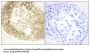 Esophageal Cancer Related Gene 4 (ECRG4) Antibody