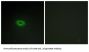 Esophageal Cancer Related Gene 4 (ECRG4) Antibody