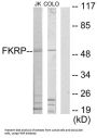 Fukutin Related Protein (FKRP) Antibody