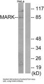 Serine/threonine-Protein Kinase MARK1 (MARK) Antibody