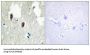 Kelch-Like Protein 3 (KLHL3) Antibody
