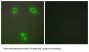 Kelch-Like Protein 3 (KLHL3) Antibody