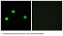 Inositol Hexakisphosphate Kinase 2 (IP6K2) Antibody