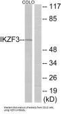 Zinc Finger Protein Aiolos (IKZF3) Antibody