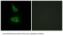 Cadherin 17 (CDH17) Antibody
