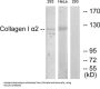 Collagen Type I Alpha 2 (COL1A2) Antibody