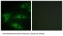 Collagen Type I Alpha 2 (COL1A2) Antibody