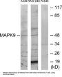 Mitogen-Activated Protein Kinase 9 / JNK2 (MAPK9) Antibody