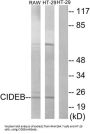 Cell Death-Inducing DFFA-Like Effector B (CIDEB) Antibody
