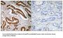 Menin (MEN1) Antibody