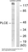 1-Acylglycerol-3-Phosphate O-Acyltransferase 5 (AGPAT5) Antibody