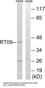 Mitochondrial Ribosomal Protein S9 (MRPS9) Antibody