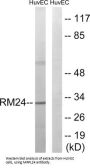 Mitochondrial Ribosomal Protein L24 (MRPL24) Antibody
