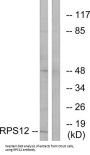 Ribosomal Protein S12 (RPS12) Antibody