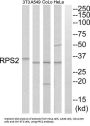 Ribosomal Protein S2 (RPS2) Antibody