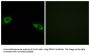 Small Ribosomal Subunit Protein eS4, Y Isoform 1 (RPS4Y1) Antibody