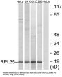 Ribosomal Protein L35 (RPL35) Antibody