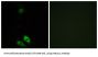 Aldo-Keto Reductase Family 1 Member C-Like Protein 1 (AKR1CL1) Antibody