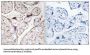 Alkaline Ceramidase 3 (ACER3) Antibody
