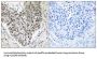 Amyotrophic Lateral Sclerosis 2 Chromosomal Region Candidate Gene 8 Protein (ALS2CR8) Antibody