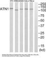 Atrophin 1 (ATN1) Antibody