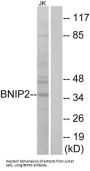 BCL2 Interacting Protein 2 (BNIP2) Antibody