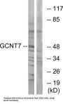 Beta-1,3-Galactosyl-O-Glycosyl-Glycoprotein Beta-1,6-N-Acetylglucosaminyltransferase 7 (GCNT7) Antibody