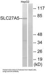Bile Acyl-CoA Synthetase (SLC27A5) Antibody