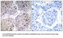 Bile Acyl-CoA Synthetase (SLC27A5) Antibody