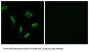 Bile Acyl-CoA Synthetase (SLC27A5) Antibody