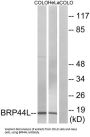 Brain Protein 44 Like Protein (BRP44L) Antibody