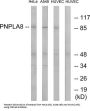 Patatin Like Phospholipase Domain Containing 8 (PNPLA8) Antibody