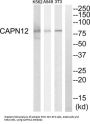 Calpain-12 (CAPN12) Antibody