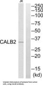 Calretinin (CALB2) Antibody