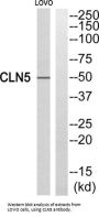 CLN5, Intracellular Trafficking Protein (CLN5) Antibody