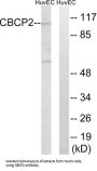 Cytosolic Carboxypeptidase 2 (CBCP2) Antibody