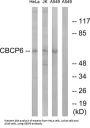 Cytosolic Carboxypeptidase 6 (AGBL4) Antibody