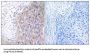 Polymerase DNA Directed Gamma 2 (POLG2) Antibody