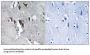 ELOVL Fatty Acid Elongase 5 (ELOVL5) Antibody