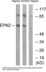Epsin 2 (EPN2) Antibody