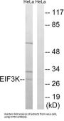 Eukaryotic Translation Initiation Factor 3 Subunit K (EIF3K) Antibody