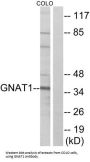 Guanine Nucleotide Binding Protein (G Protein), Alpha Transducing Activity Polypeptide 1 (GNAT1) Antibody