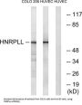 Heterogeneous Nuclear Ribonucleoprotein L-Like (HNRPLL) Antibody