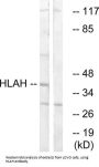 Putative HLA Class I Histocompatibility Antigen, Alpha Chain H (HLAH) Antibody