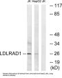 Low Density Lipoprotein Receptor Class A Domain Containing 1 (LDLRAD1) Antibody