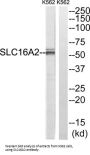 Solute Carrier Family 16 Member 2 (SLC16A2) Antibody