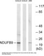 NADH Ubiquinone Oxidoreductase Subunit B9 (NDUFB9) Antibody