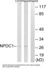 Neural Proliferation, Differentiation And Control 1 (NPDC1) Antibody